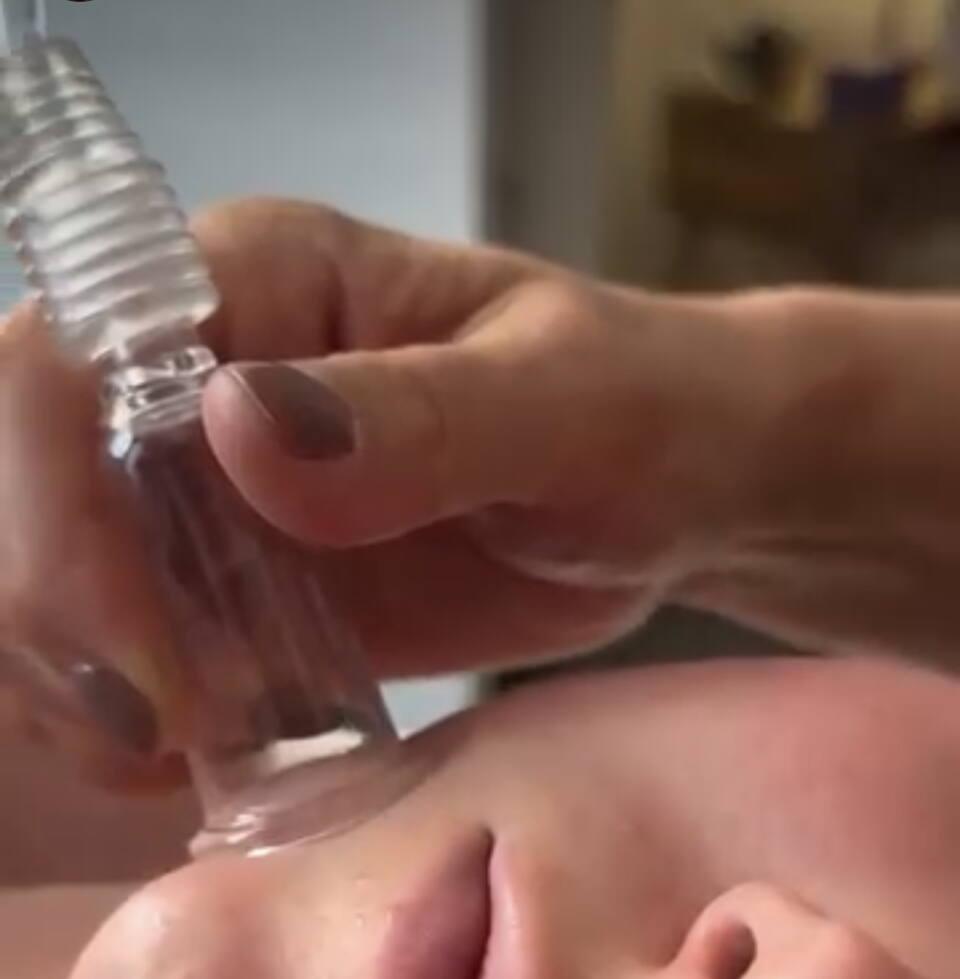 Flow Cupping Viso con coppette nello Studio Olistico Rovigo